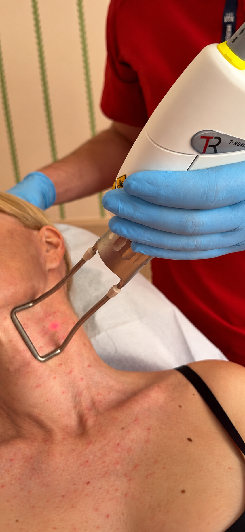 T-Runner scanner positioned over a patient's neck during treatment